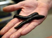 Heilpraktiker_Dietmar_Mueller_Blutegel